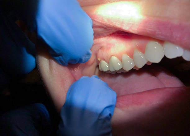 24-Hour Dental Clinic Near Me in NC